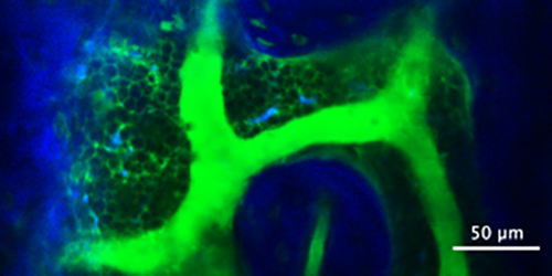 A live image of mouse bone marrow showing cells (green circles) visualized by the negative contrast technique. Blood vessels (green tubes) and bone (blue) are also visualized.